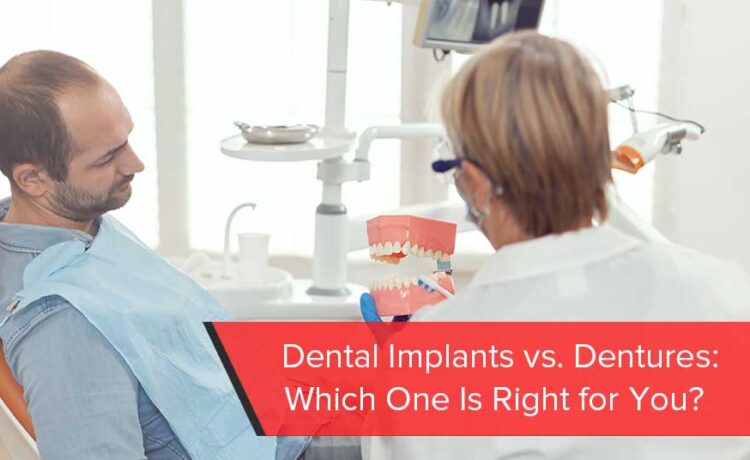 Dental Implants vs. Dentures